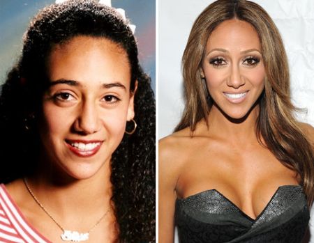 Melissa Gorga is open about her body modification surgeries.